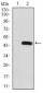 Rab8 Antibody
